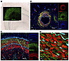 Bilirubin deposition is observed primarily in the tunica media of coronary