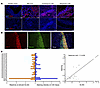 Monoclonal antibodies derived from intragraft PCs react to cardiac tissue w
