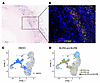 Heme degradation is prominent in the tunica media of coronary arteries with
