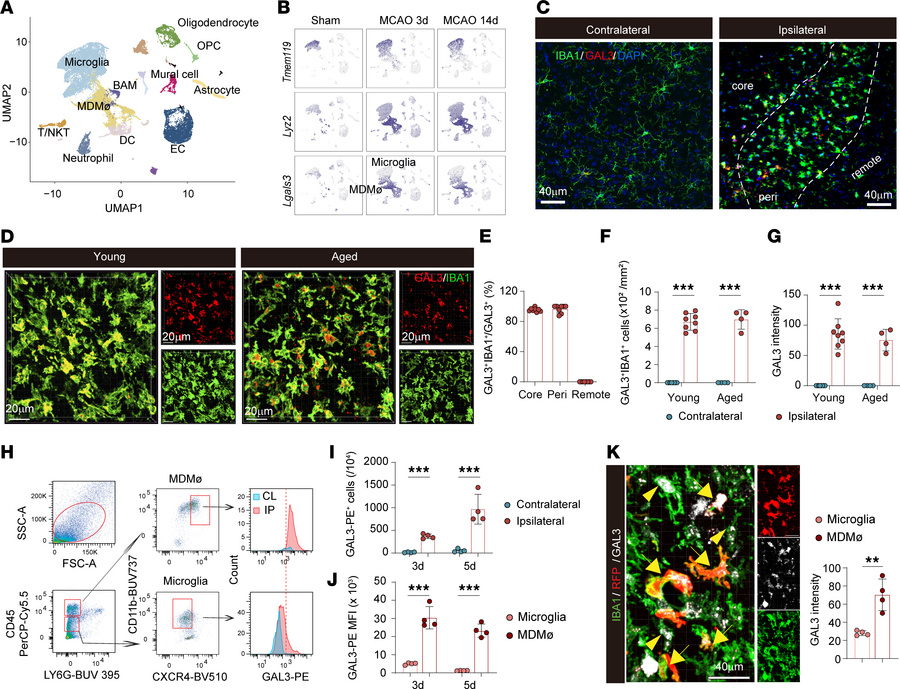 GAL3 expression is rapidly increased in brain-invading MDMø after ischem...