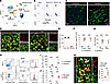 GAL3 expression is rapidly increased in brain-invading MDMø after ischemic