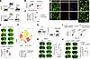 GAL3 expression in monocyte/Mø is instrumental in infarct expansion in the