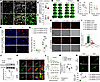 High GAL3 expression in MDMø amplifies cathepsin induction and leakage afte