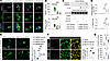 GAL3-mediated cathepsin induction enhances NLRP3 expression in MDMø and amp
