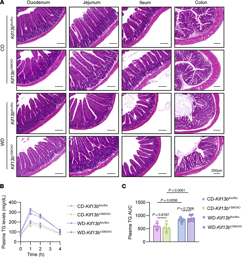 VSMC-specific Kif13b deletion does not affect intestinal morphology or l...