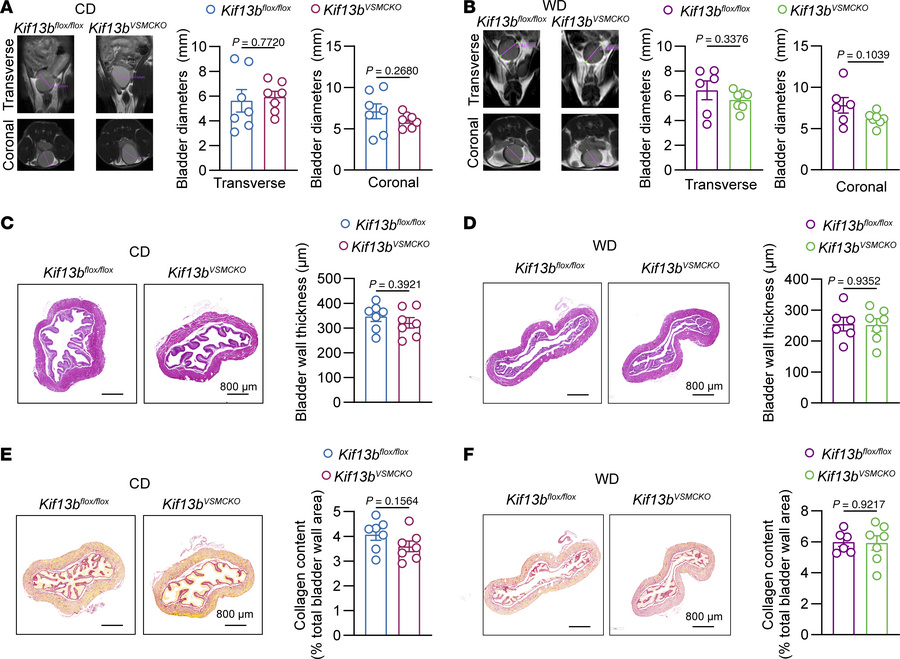 
Kif13b deficiency in VSMCs does not cause bladder remodeling.
Eight-wee...