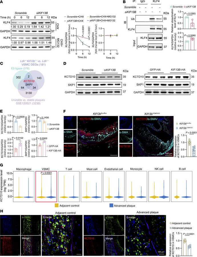 KIF13B drives KLF4 degradation in atherosclerosis through KCTD10-mediate...