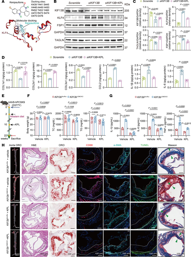 Pharmacological inhibition of KLF4 effectively ameliorates atheroscleros...