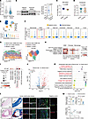 Decreased expression of KIF13B in VSMCs is associated with more severe huma