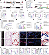 VSMC-specific Kif13b KO exacerbates atherosclerosis in mice.