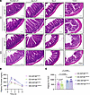 VSMC-specific Kif13b deletion does not affect intestinal morphology or lipi
