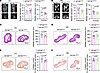 Kif13b deficiency in VSMCs does not cause bladder remodeling.