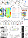 KIF13B directs VSMC transition to a matrix-stabilizing phenotype.