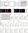 KLF4 acts downstream of KIF13B to drive proinflammatory reprogramming in VS