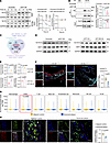 KIF13B drives KLF4 degradation in atherosclerosis through KCTD10-mediated u