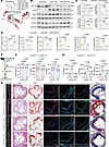 Pharmacological inhibition of KLF4 effectively ameliorates atherosclerosis