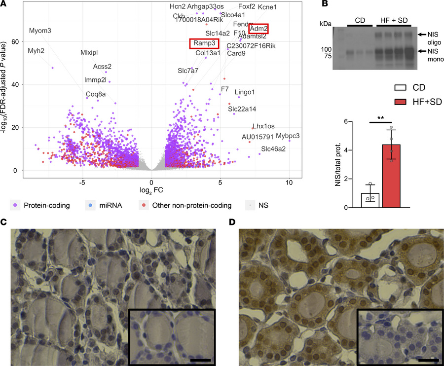 High TSH signaling appears unimpaired and likely drives thyroidal vascul...