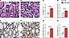 Overnutrition leads to hypertrophy, increased granularity, and increased va