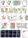 HCAFs interact strongly with tumor cells and are linked to lymphangiogenesi