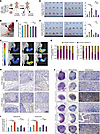 CLEC11A promotes lymphangiogenesis and metastasis in vivo.
