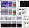 CLEC11A promotes lymphatic vessel abnormalities and lymphangiogenesis in vi