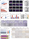 CLEC11A promotes EMT and VEGFC production in tumor cells, leading to lympha