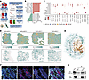 CLEC11A promotes lymphangiogenesis and lymphatic metastasis through its int