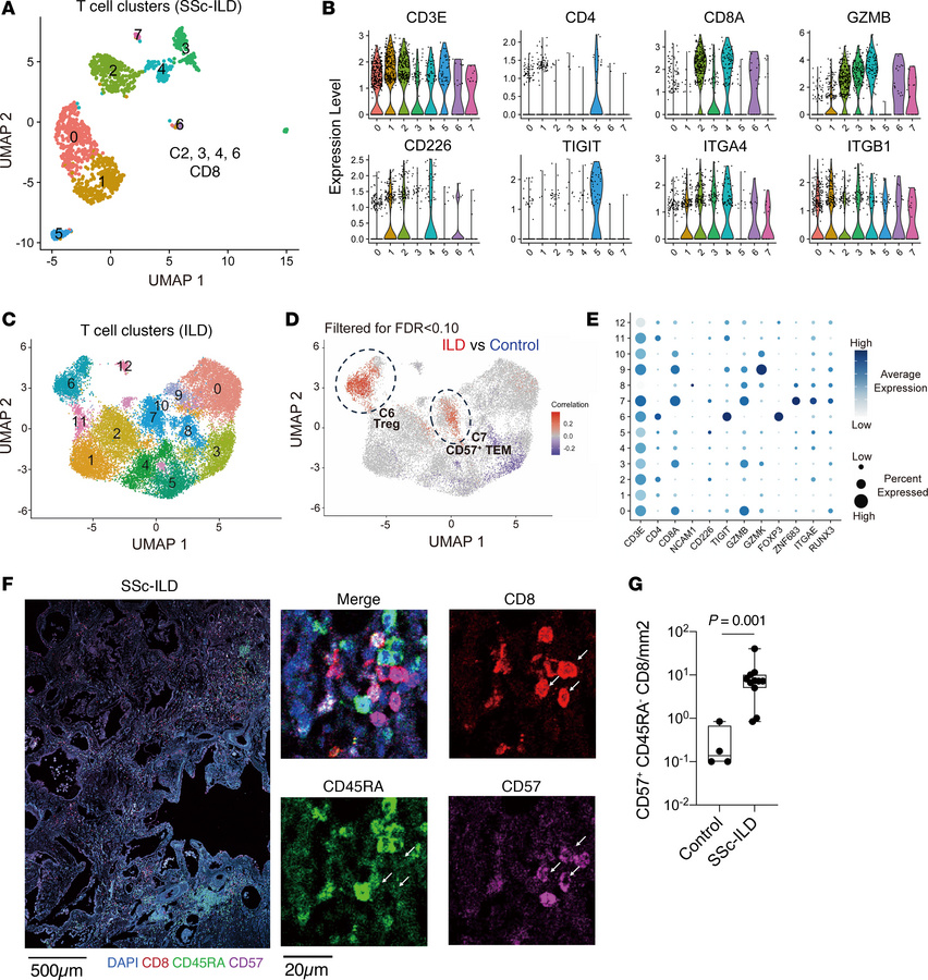 CD57+ Tem cells are expanded in SSc-ILD lung tissues.
(A) UMAP clusterin...