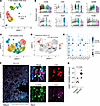 CD57+ Tem cells are expanded in SSc-ILD lung tissues.