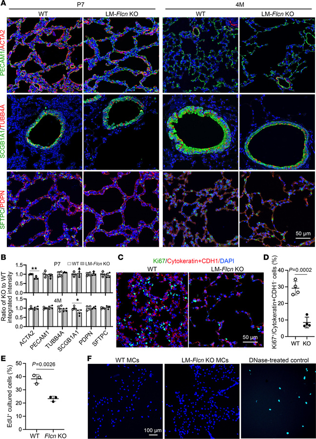 Mesenchymal Flcn deletion influences lung cell growth directly and indir...