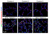 Increased pS6 in human BHD lung tissue specimens.