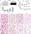 Deletion of Flcn in lung mesenchyme results in abnormal alveolar developmen