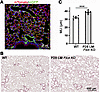 Abrogation of lung mesenchymal Flcn after completion of lung development re