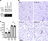 Lack of effect of epithelial Flcn deletion in alveolar structure, either al