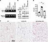 Genetic inactivation of mTORC1 pathway by deleting Rptor in lung mesenchyma