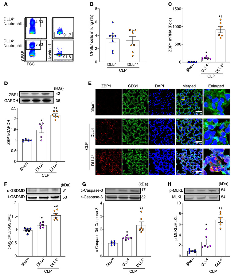 DLL4+ neutrophils induce lung endothelial cell PANoptosis in sepsis.
BMD...