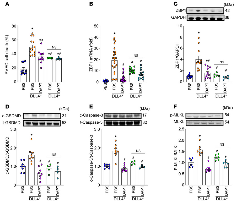 DAPT attenuates endothelial PANoptosis by inhibiting Notch1-DLL4 interac...