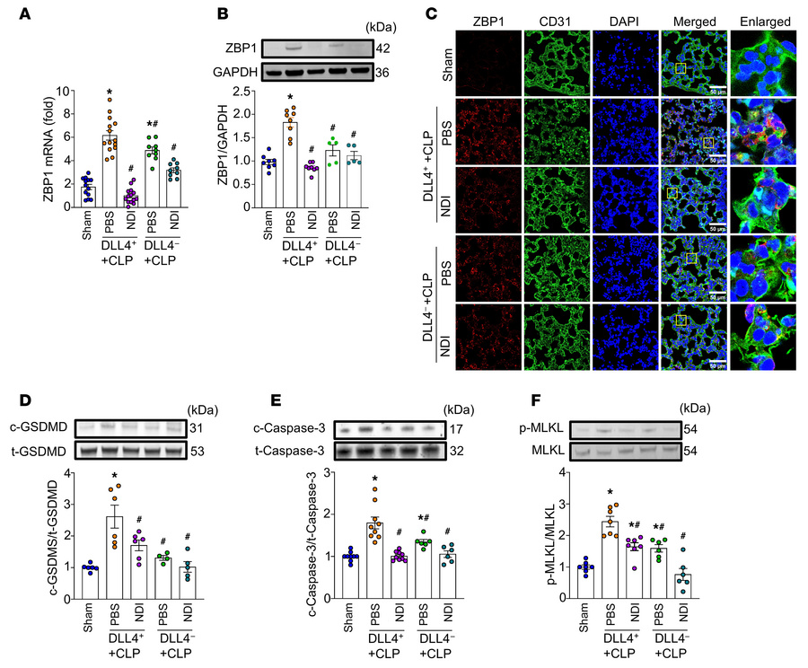 NDI attenuates PVEC PANoptosis by inhibiting Notch1-DLL4 interaction in ...