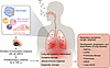 Mechanisms by which PM air pollution affects the respiratory system.