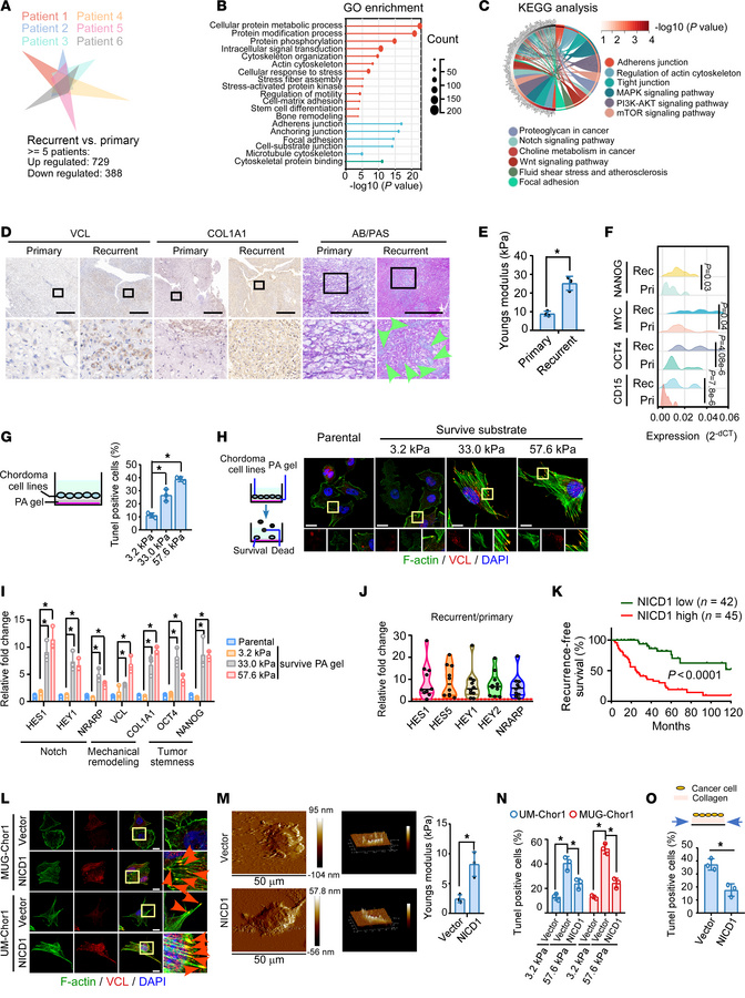 Mechanical properties of remodeling and increased tumor stemness were id...