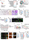 Mechanical properties of remodeling and increased tumor stemness were ident