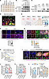 Increased NICD1 O-GlcNAcylation contributes to aberrant Notch signaling act