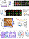 NICD1 O-GlcNAcylation promotes tumor mechanical properties remodeling and t