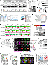 O-GlcNAcylation of T2063, T2090, and S2162 enhances NICD1 stability and tra