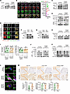 EPHA2 perceives ECM stiffness to induce LYN phosphorylation.