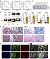 Loss of NF2 facilitates aggressive progression of acinar-derived human PDAC