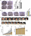 NF2 loss drives autonomous WNT7B secretion to support acinar growth.