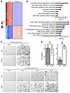 NF2 inactivation promotes cell survival under nutrient deprivation.