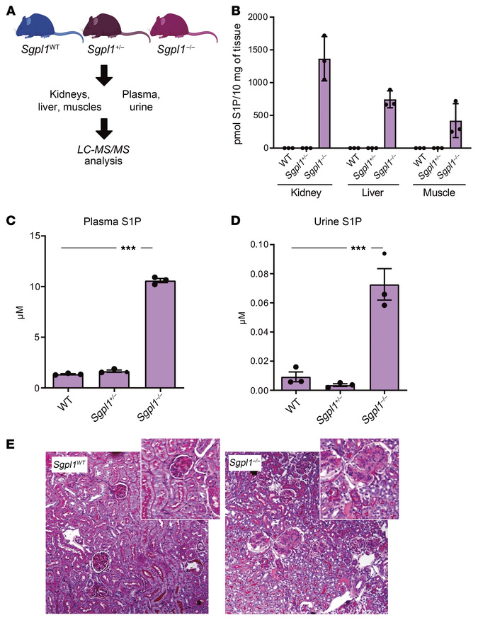 Analysis of S1P levels and kidney pathology in Sgpl1 mice.
(A) Schematic...
