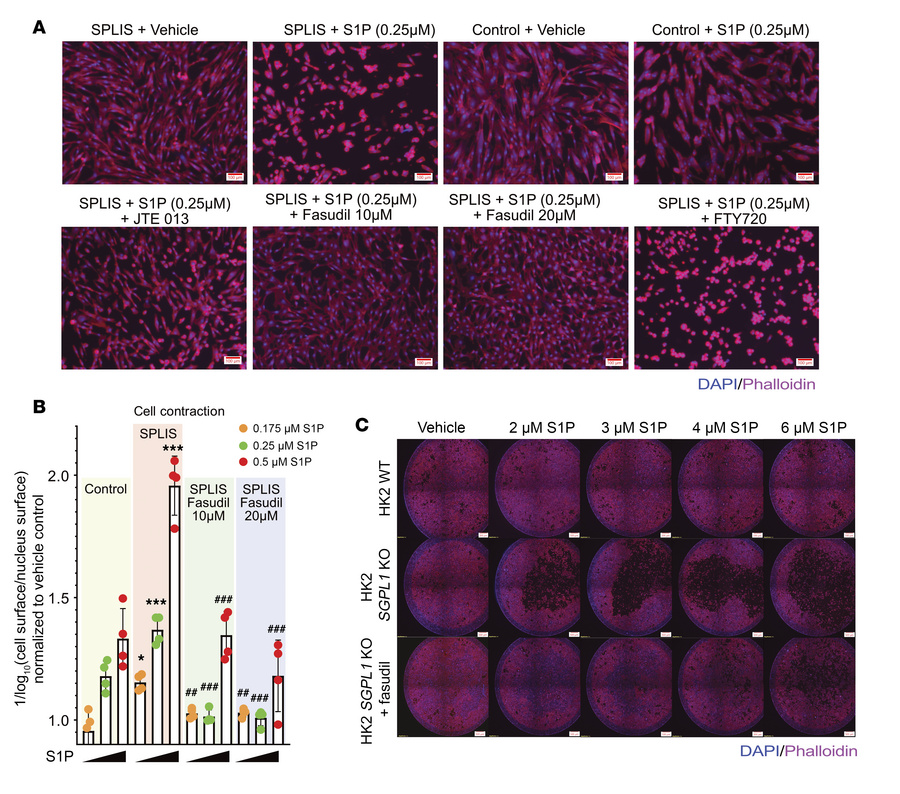 Fasudil rescues S1P induced cytoskeletal phenotypes in SPLIS fibroblasts...